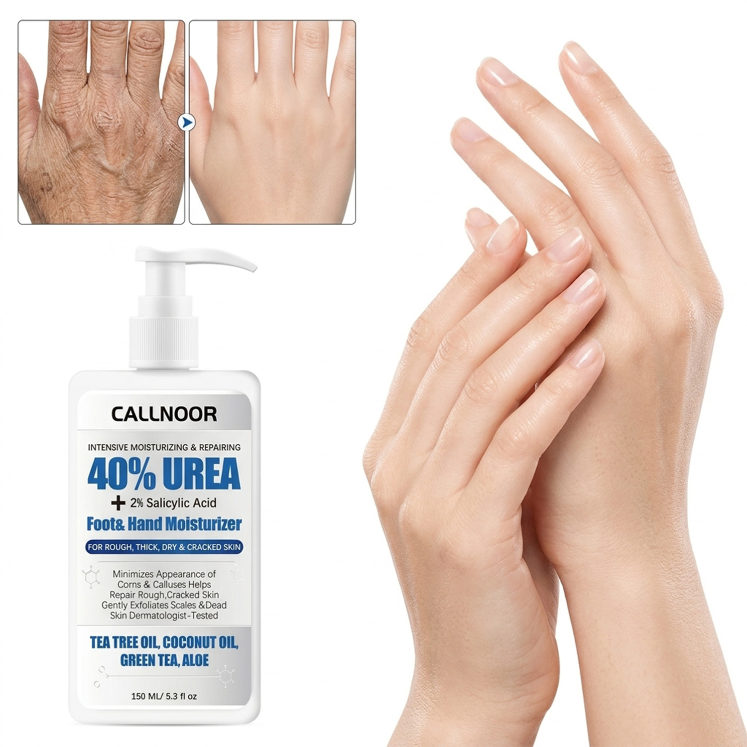 Urea Foot Cream - Krim Tangan dan Kaki 0% Urea