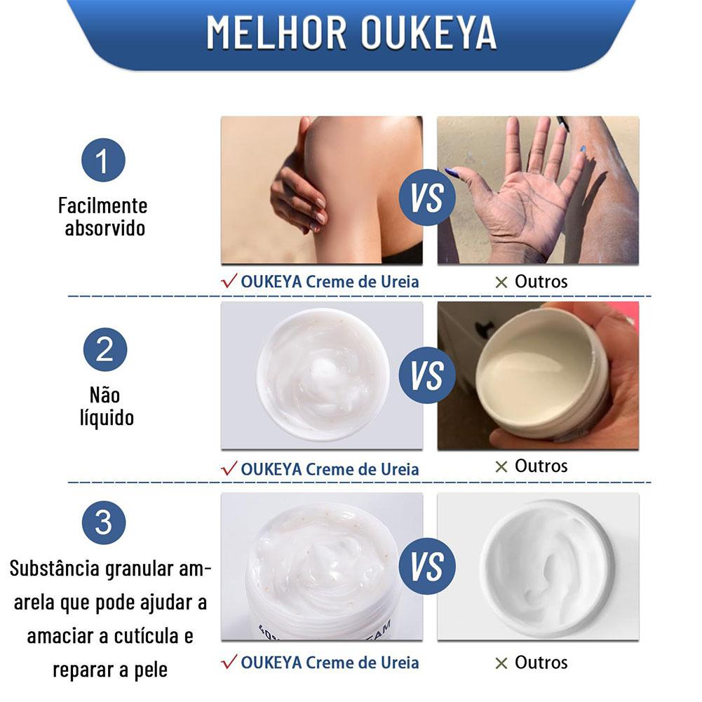 Krim Urea 40% Krim Pelembab An - Urea Foot Cream ulasan dan harga
