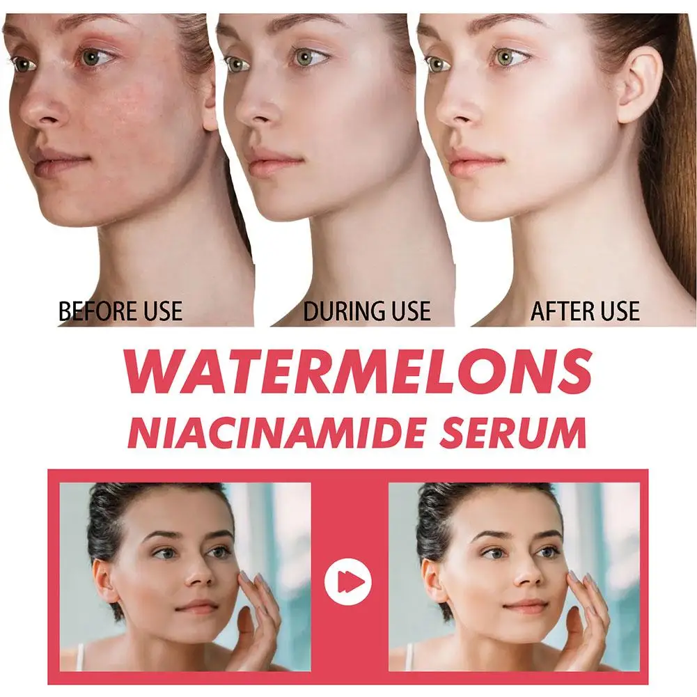 Serum Pelembab Niacinamide Cah - Niacinamide Brightening Serum ulasan dan harga